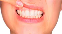 Periodoncia